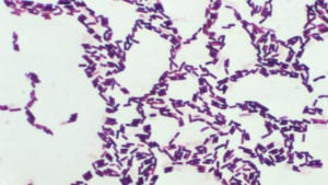 Bacillus spores. Image from the Centers for Disease Control and Prevention's Public Health Image Library.